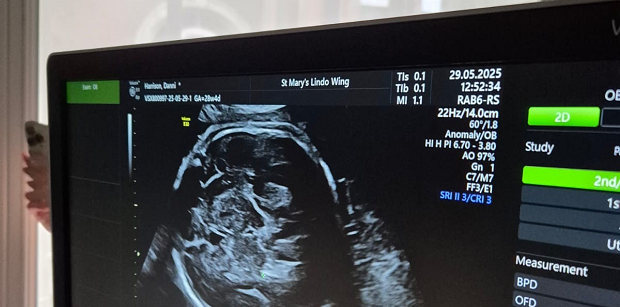 Fetal Scanning Price List 620X307