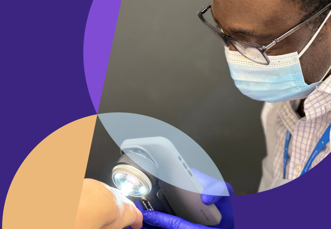 Mole Assessment Image
